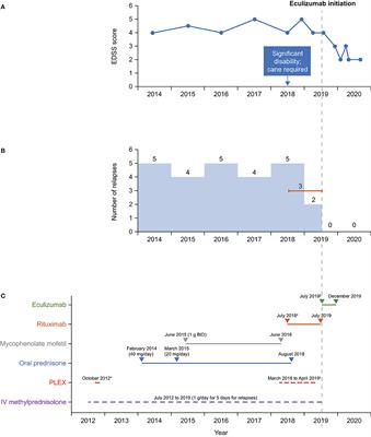 Eculizumab in the Treatment of Aquaporin-4 Seronegative Neuromyelitis Optica Spectrum Disorder: A Case Report
